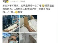陈学冬消失2年首晒照！头发花白面容憔悴车祸后遗症如此严重？-二哈突然不见了